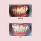 【導入キャンペーン】話題の水素ベッドが初回20分500円！ホワイトニングと同時施術でさらにキレイに✨